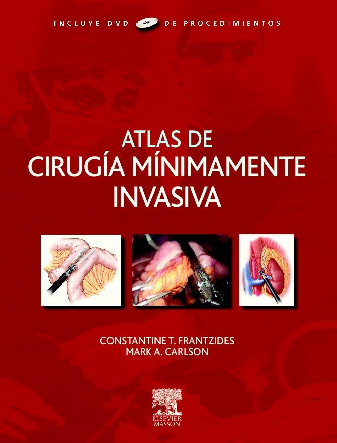 ATLAS DE CIRUGIA MINIMAMENTE INVASIVA(+DVD) | 9788445819562 | FRANTZIDES,CONSTANTINE T. | Libreria Geli - Librería Online de Girona - Comprar libros en catalán y castellano