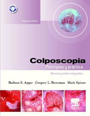 COLPOSCOPIA PRINCIPIOS Y PRACTICA | 9788445812761 | APGAR,BARBARA S./BROTZMAN GREGORY L./SPITZER,MARK | Libreria Geli - Librería Online de Girona - Comprar libros en catalán y castellano
