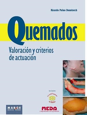 QUEMADOS.VALORACION Y CRITERIOS DE ACTUACION | 9788415340140 | PALAO DOMENECH,RICARDO | Llibreria Geli - Llibreria Online de Girona - Comprar llibres en català i castellà