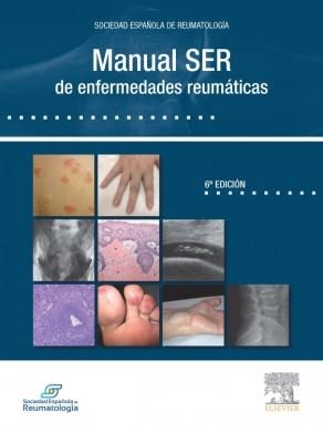 MANUAL SER DE ENFERMEDADES REUMATICAS(6ª EDICION 2014) | 9788490229033 | Libreria Geli - Librería Online de Girona - Comprar libros en catalán y castellano