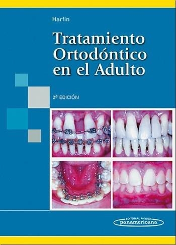 TRATAMIENTO ORTODÓNTICO EN EL ADULTO(2ª EDICIÓN) | 9789500609296 | HARFIN,JULIA | Llibreria Geli - Llibreria Online de Girona - Comprar llibres en català i castellà