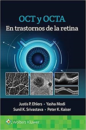OCT Y OCTA EN TRASTORNOS DE LA RETINA | 9788418563126 | Llibreria Geli - Llibreria Online de Girona - Comprar llibres en català i castellà