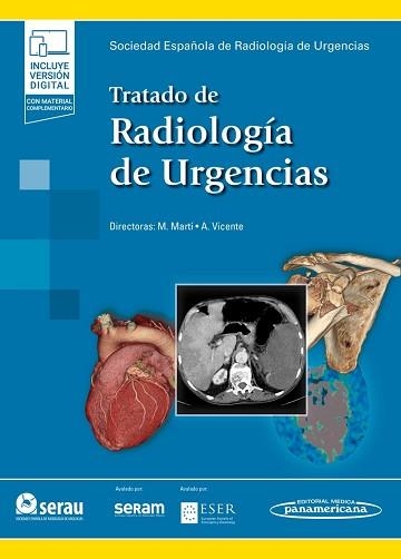 TRATADO DE RADIOLOGÍA DE URGENCIAS | 9788491106968 | MARTÍ DE GRACIA,MILAGROS/VICENTE BÁRTULOS,AGUSTINA | Libreria Geli - Librería Online de Girona - Comprar libros en catalán y castellano
