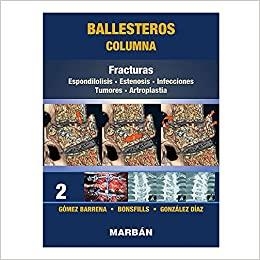 COLUMNA-2.FRACTURAS | 9788418068485 | GÓMEZ BARRENA | Libreria Geli - Librería Online de Girona - Comprar libros en catalán y castellano