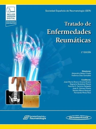 TRATADO DE ENFERMEDADES REUMÁTICAS(2ª EDICIÓN 2022) | 9788411060332 | Libreria Geli - Librería Online de Girona - Comprar libros en catalán y castellano