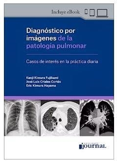 DIAGNOSTICO POR IMAGENES DE LA PATOLOGIA PULMONAR | 9789878452746 | KIMURA | Libreria Geli - Librería Online de Girona - Comprar libros en catalán y castellano