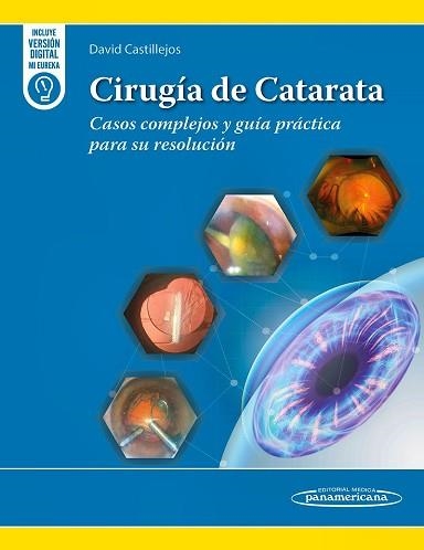 CIRUGÍA DE CATARATA.CASOS COMPLEJOS Y GUÍA PRÁCTICA PARA SU RESOLUCIÓN | 9789689727002 | CASTILLEJOS,D. | Libreria Geli - Librería Online de Girona - Comprar libros en catalán y castellano