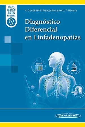 DIAGNÓSTICO DIFERENCIAL EN LINFADENOPATÍAS | 9788411066129 | GONZÁLEZ GARCÍA,ANDRÉS/MONTES MORENO,SANTIAGO | Llibreria Geli - Llibreria Online de Girona - Comprar llibres en català i castellà