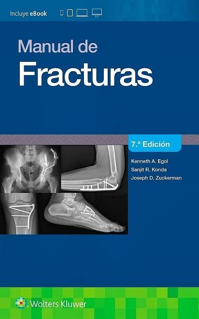 MANUAL DE FRACTURAS(7ª EDICIÓN 2026) | 9788410871397 | EGOL, K./KONDA, S./ZUCKERMAN, J. | Llibreria Geli - Llibreria Online de Girona - Comprar llibres en català i castellà